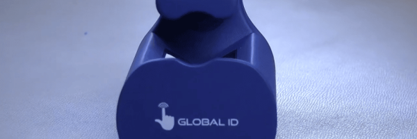 Global ID VenoScanner